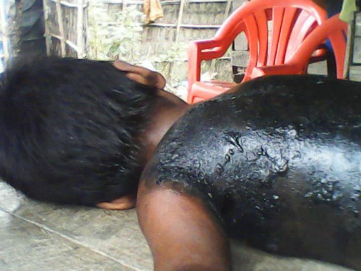 نقره لعرض الصورة في صفحة مستقلة